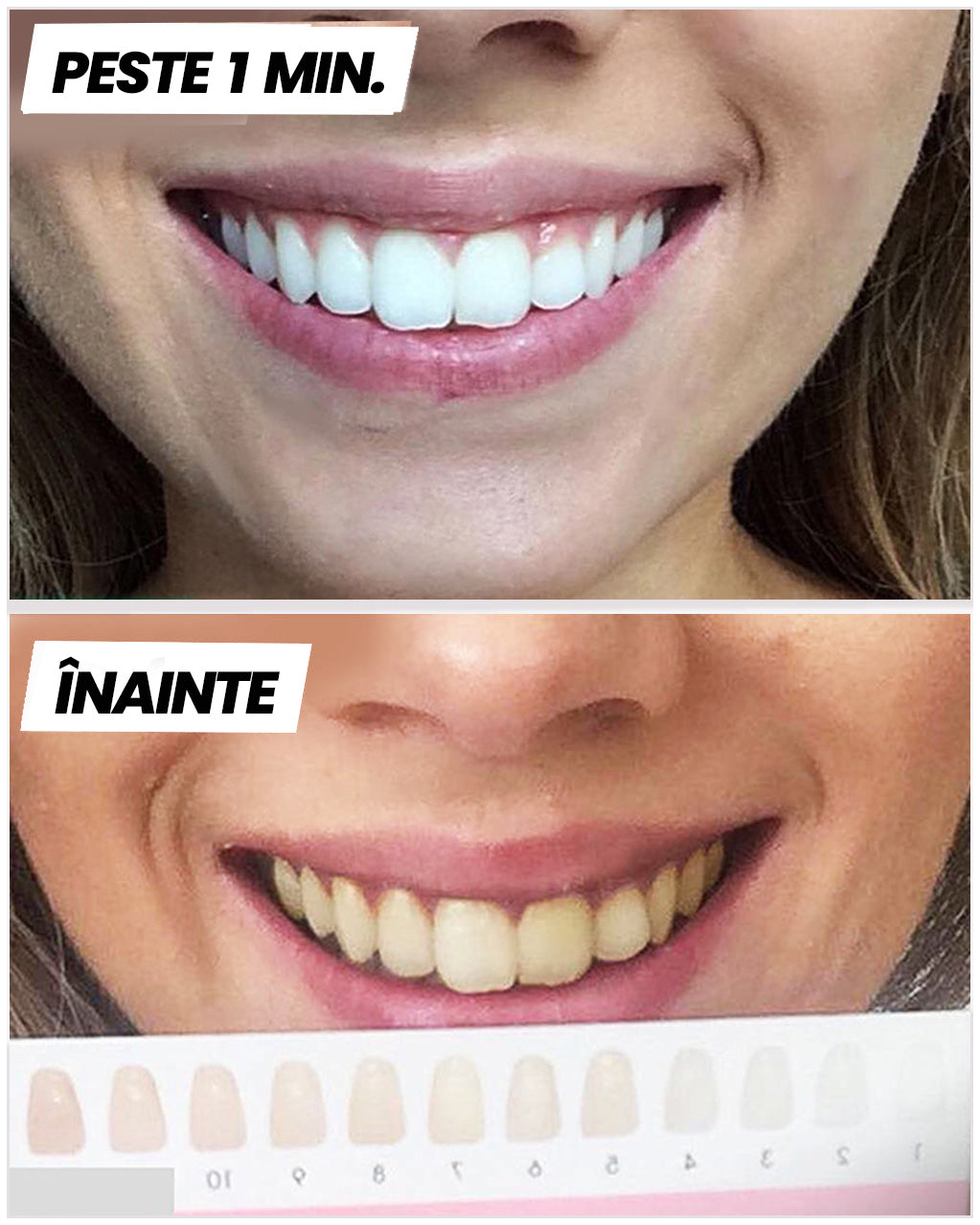 Benzi pentru Albirea dinților™ - clicksmile.net 